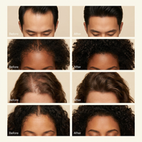 Korean Scalp Reset Shampoo